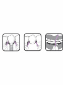 EKULF ImplantFloss Tandtråd 50 st