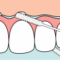 TePe Bridge & Implant Floss 30 st