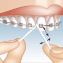 Miradent Mirafloss Implant Blå 50 st 2,2 mm